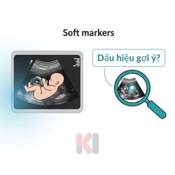 Infographic giải thích soft markers là dấu hiệu gợi ý.