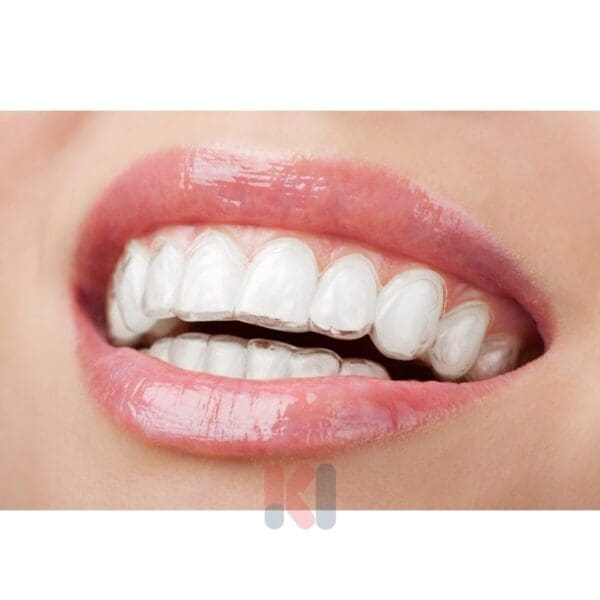 Niềng răng Invisalign đảm bảo thẩm mỹ, giúp tự tin khi giao tiếp.
